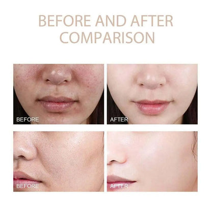 80ml White Black Rice Exfoliating Essence For Sensitive Skin Deep Hydration Gentle Peel Moisturizing Barrier Repair Natural Care